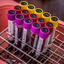 Close-up of colorful blood test tubes in a metal rack for laboratory analysis.